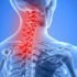 درمان آرتروز گردن Neck arthritis treatment