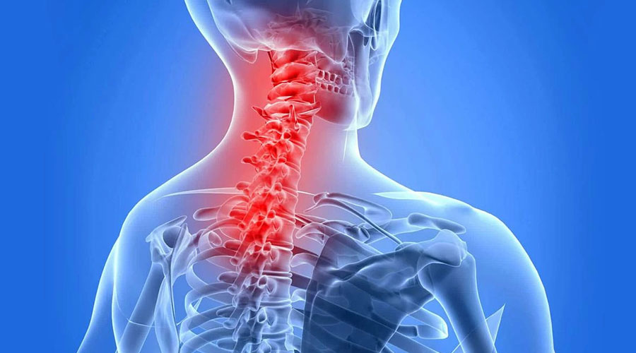 درمان آرتروز گردن Neck arthritis treatment