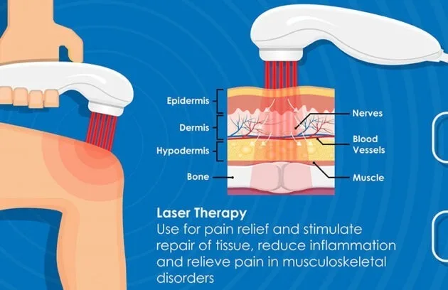 Laser-Therapy یا لیزر تراپی