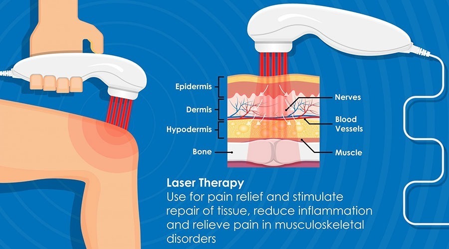 Laser-Therapy یا لیزر تراپی