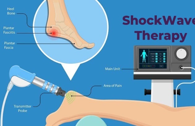 شاک ویو تراپی یا shock wave therapy