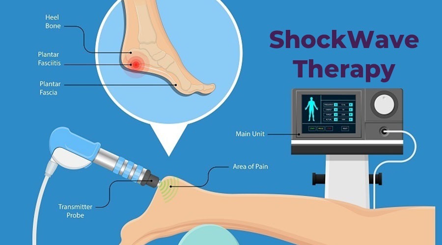 شاک ویو تراپی یا shock wave therapy