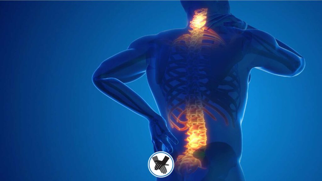 معرفی انواع دیسک کمر + علائم آن