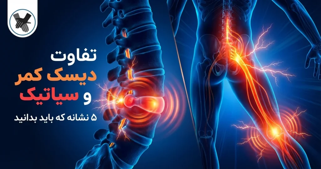 تفاوت دیسک کمر و سیاتیک: ۵ نشانه که باید بدانید