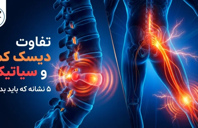 تفاوت دیسک کمر و سیاتیک: ۵ نشانه که باید بدانید