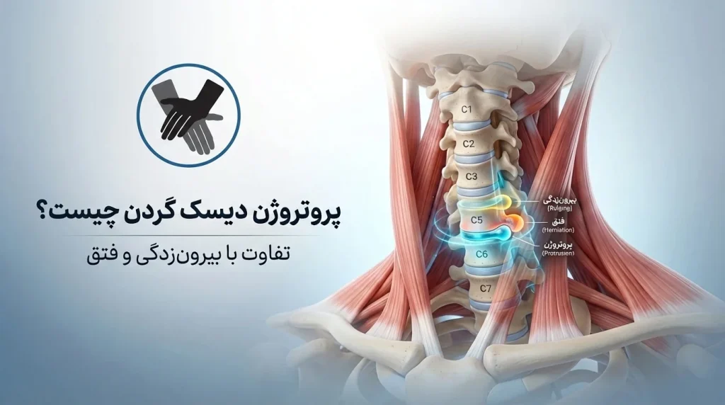 پروتروژن دیسک گردن چیست؟ [تفاوت با بیرون زدگی و فتق]