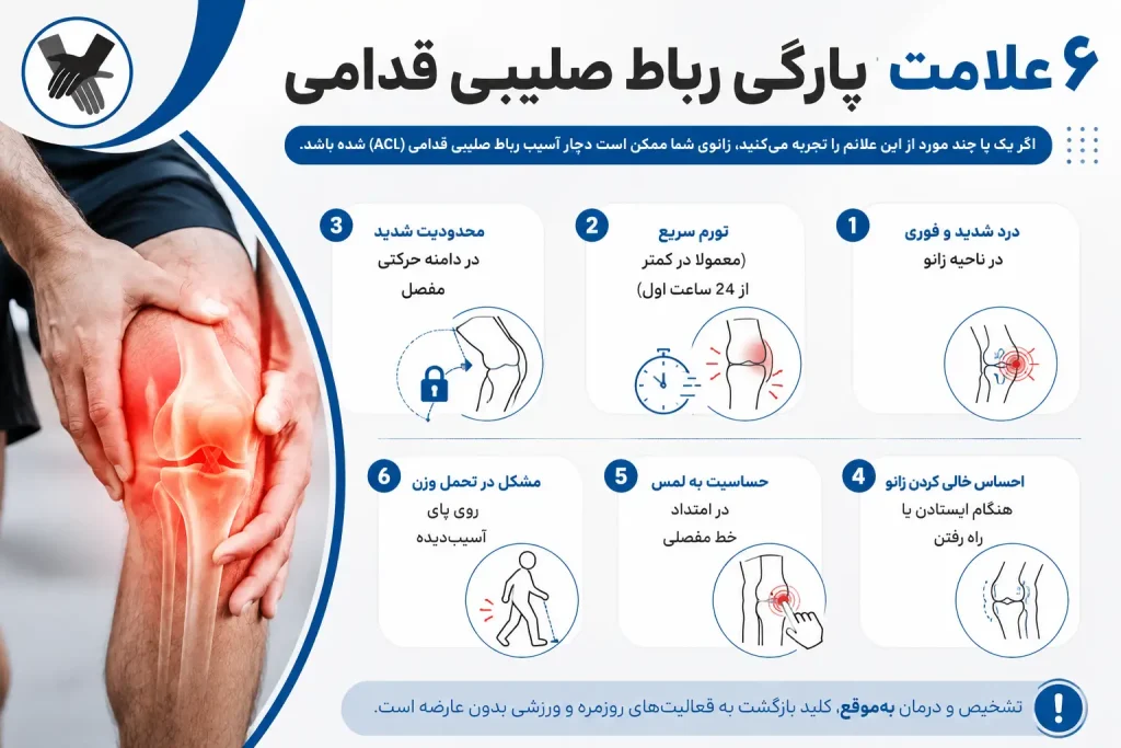 ۶ علامت پارگی رباط صلیبی قدامی