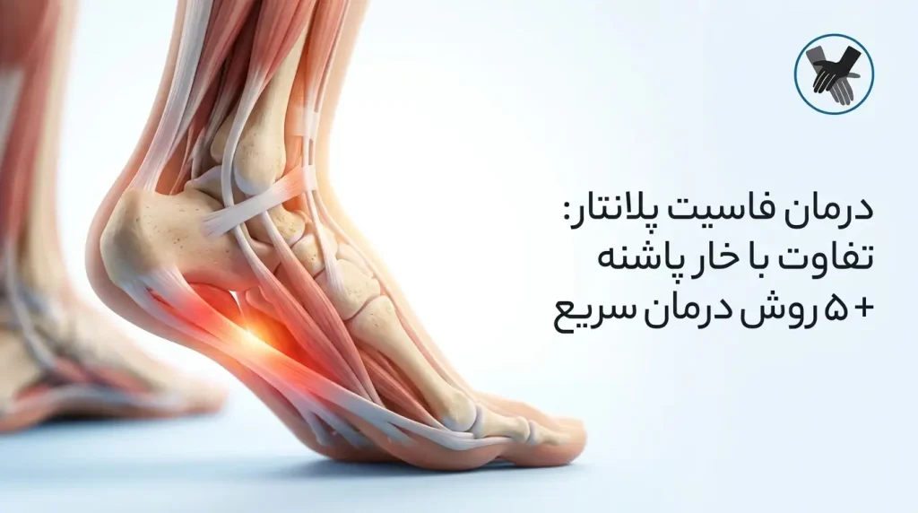 درمان فاسیت پلانتار (Plantar Fasciitis): تفاوت با خار پاشنه + 5 روش درمان سریع