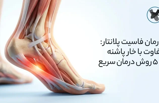 درمان فاسیت پلانتار (Plantar Fasciitis): تفاوت با خار پاشنه + 5 روش درمان سریع