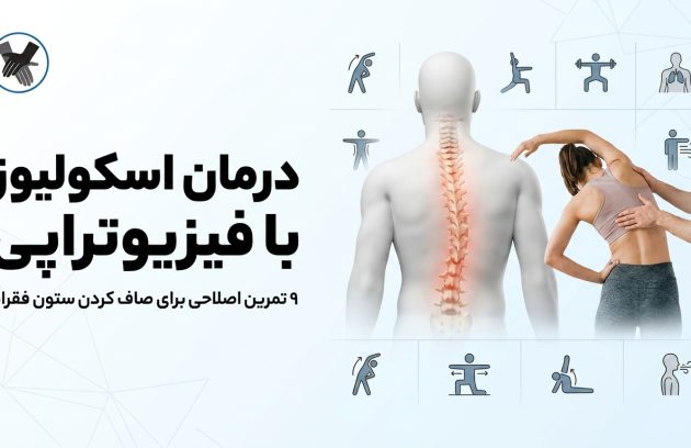 درمان اسکولیوز با فیزیوتراپی: ۹ تمرین اصلاحی برای صاف کردن ستون فقرات