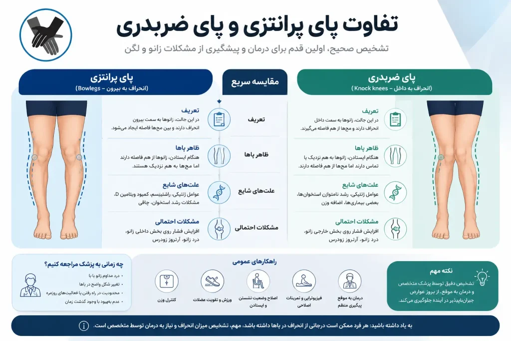 ۵ اشتباه رایج در درمان سندرم پای پرانتزی