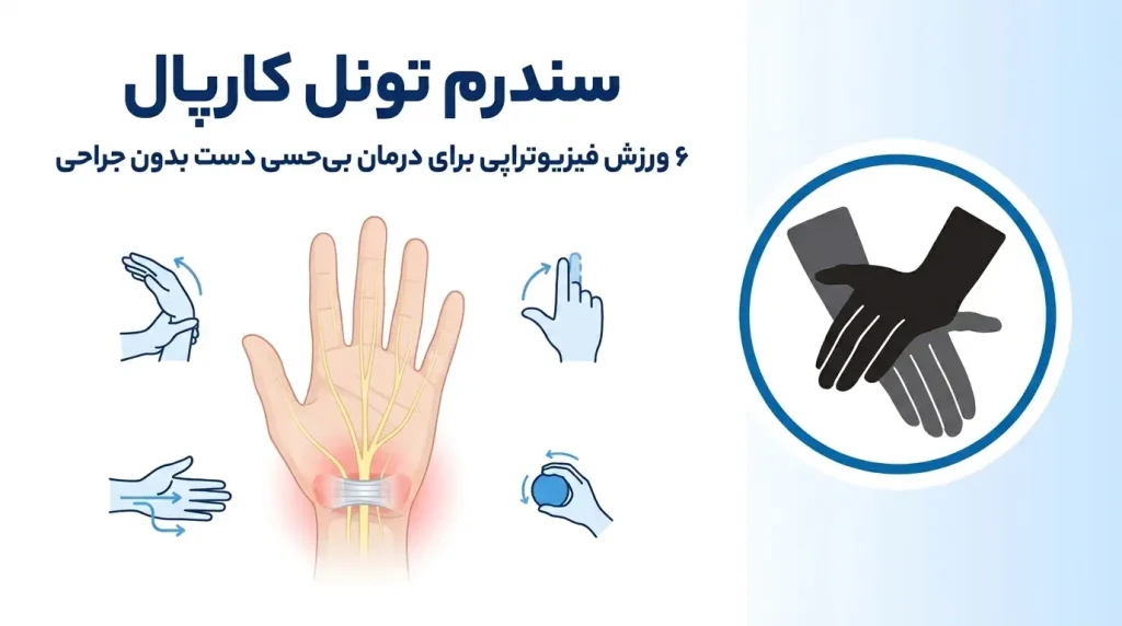 درمان سندرم تونل کارپال: 6 ورزش فیزیوتراپی برای بهل بی‌حسی دست [بدون جراحی]
