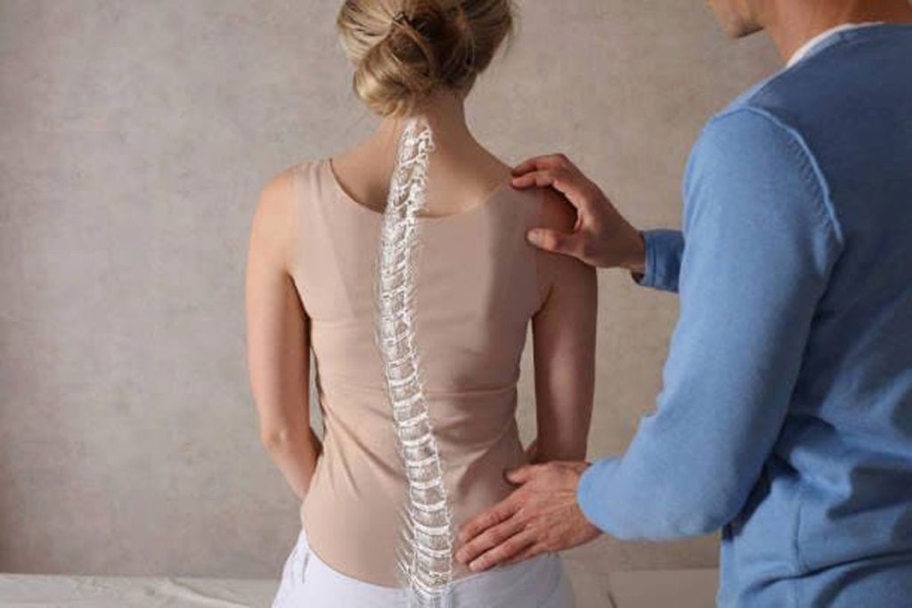 اسکولیوز چیست و چه انواعی دارد؟