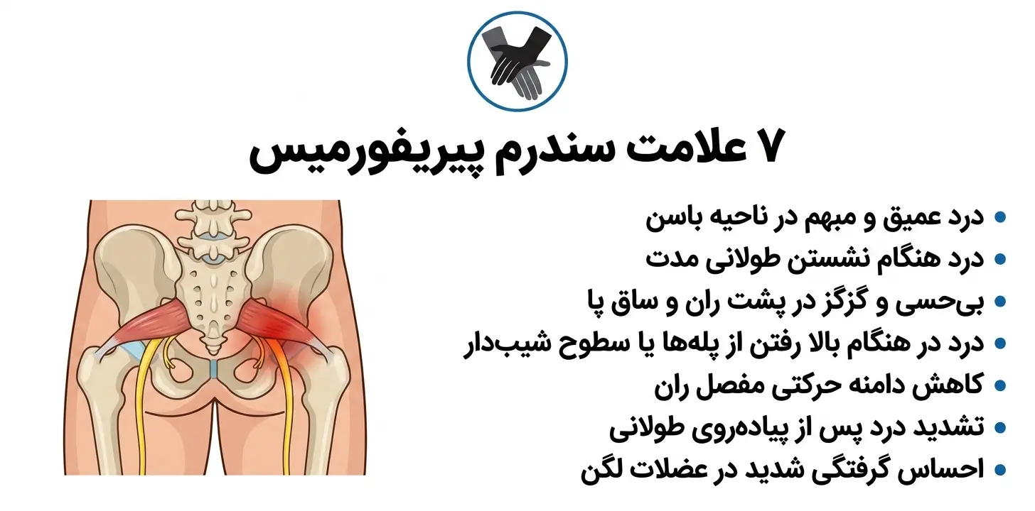 ۷ علامت سندرم پیریفورمیس