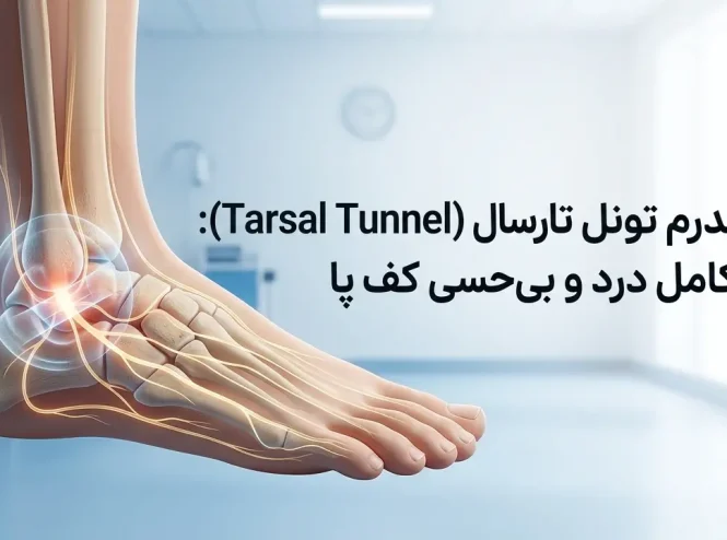 درمان سندرم تونل تارسال