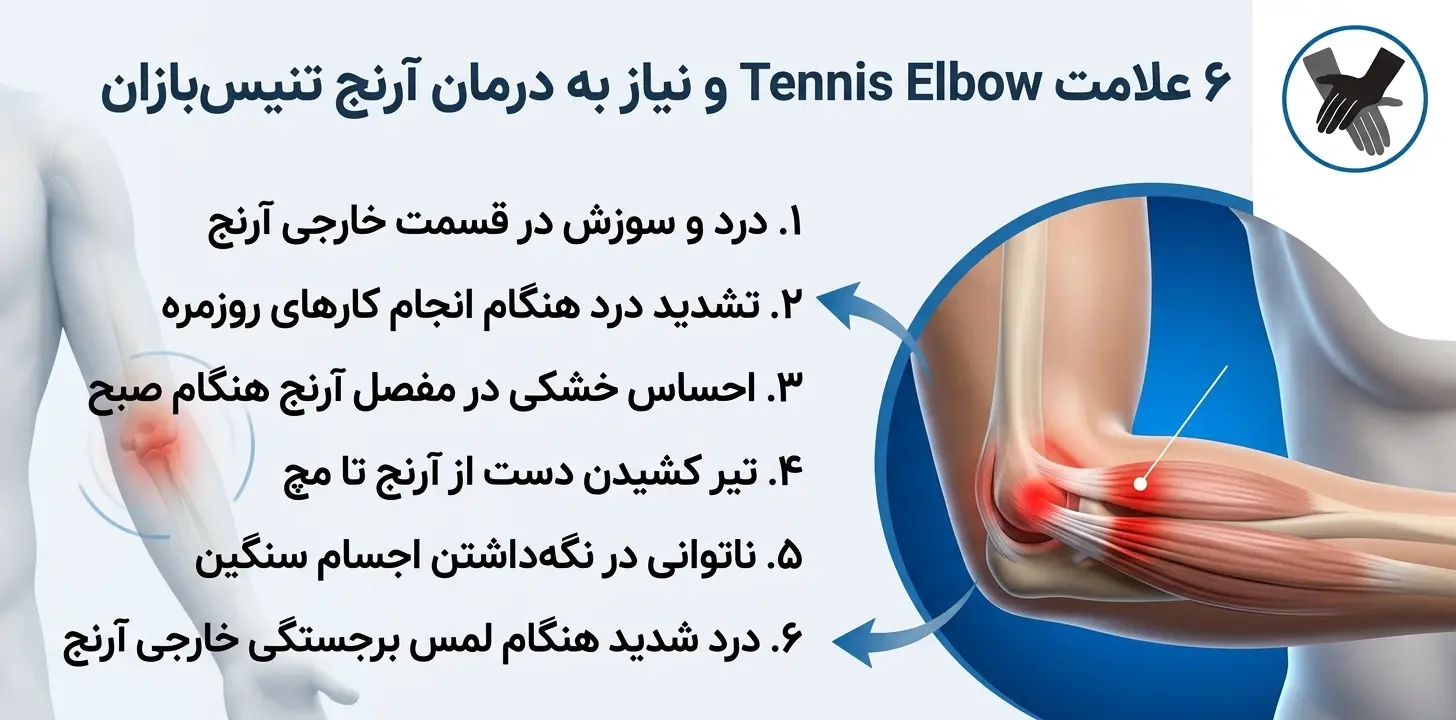 ۶ علامت Tennis Elbow و نیاز به درمان آرنج تنیس‌بازان